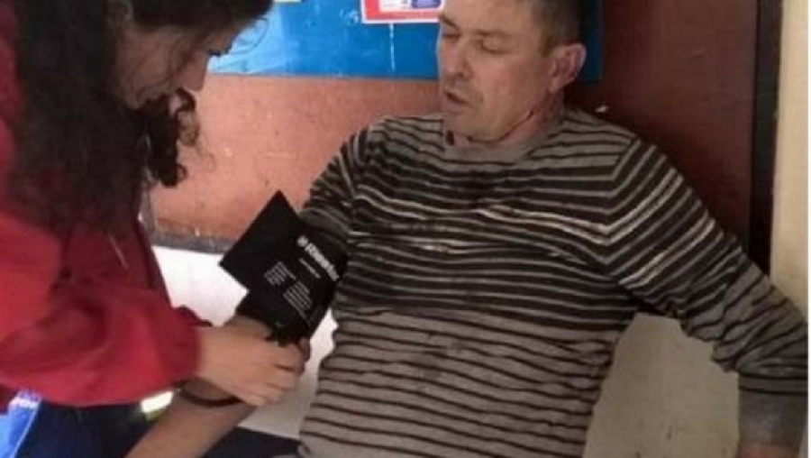 (FOTO) Prilikom pljačke pretučen vozač gradskog autobusa